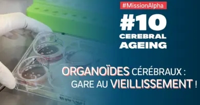 #10 Cerebral Ageing | Les expériences françaises à bord de l’ISS