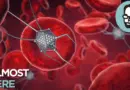 So Where Exactly Are We With Nanotechnology? | Answers With Joe
