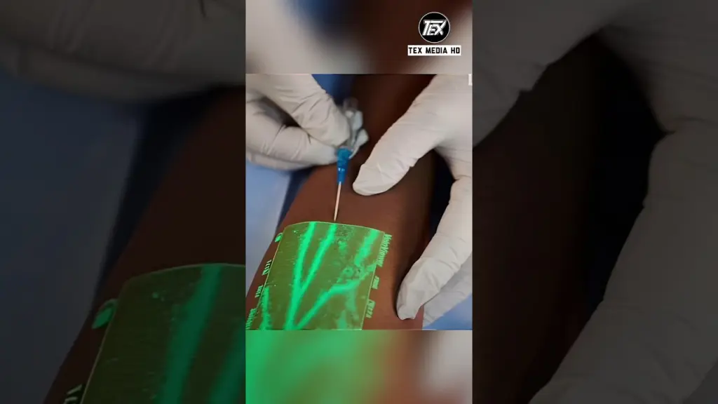 Visionneuse de veines la Nouvelle technologie Médicale 2025.